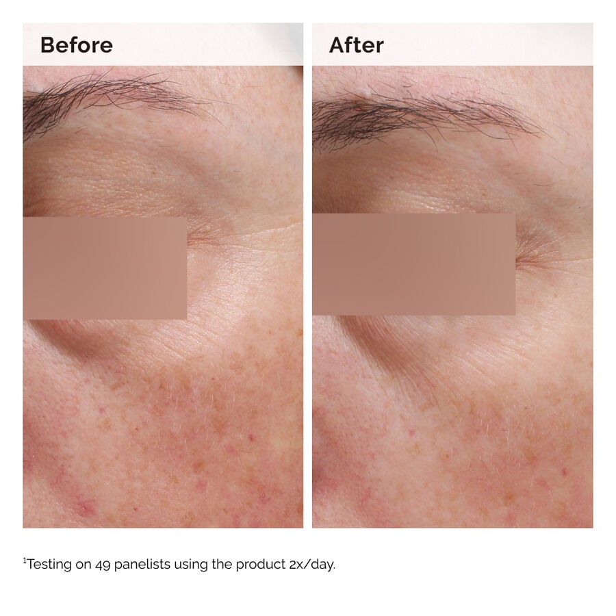 niacinamide-5-face-and-body-emulsion-o5 2024-08-23-ORD-Nia-5pct-Face-Body-B-A-Elasticity-Global-02-1x1.jpg