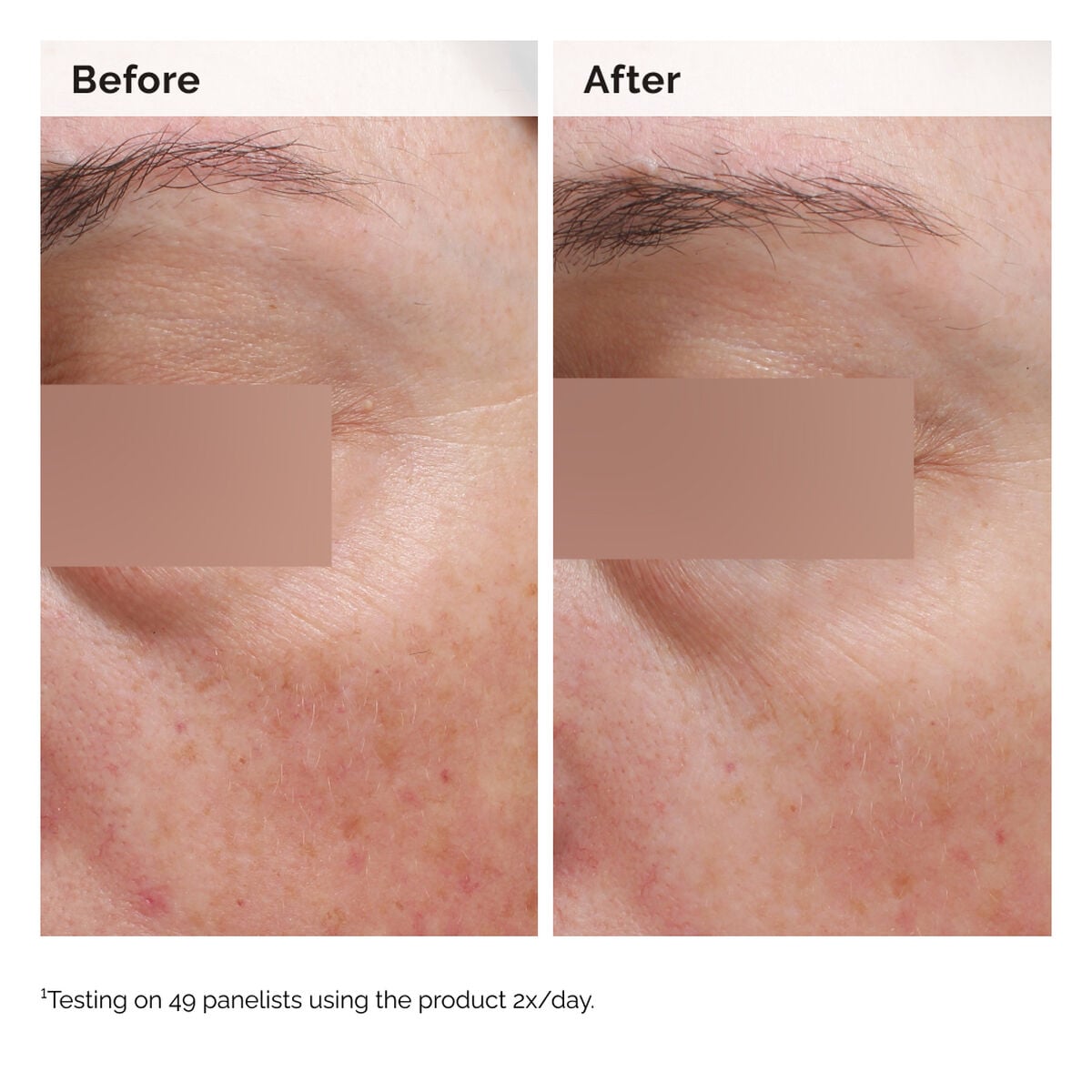 niacinamide-5-face-and-body-emulsion-o5 2024-08-23-ORD-Nia-5pct-Face-Body-B-A-Elasticity-Global-02-1x1.jpg
