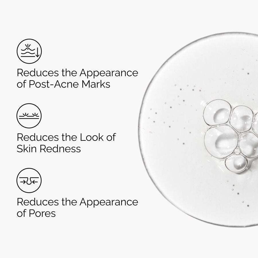 aloe-2-nag-2-solution-q1 FY25-D41247-ORD-Web-PDP-Aloe-Nag-1x1-EN-3a.jpg