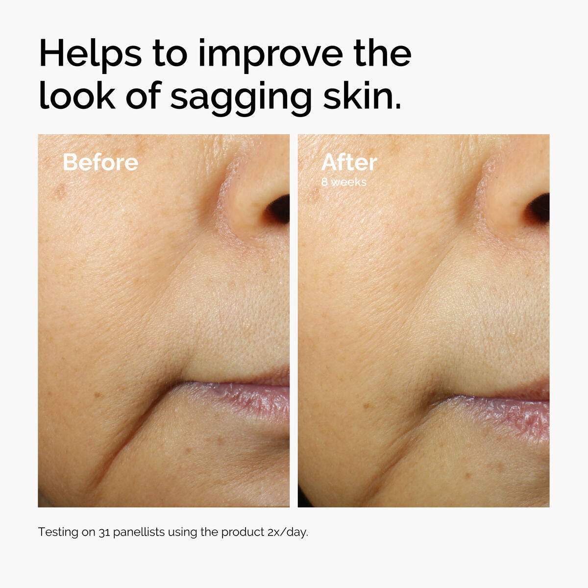 caffeine-3-escin-1-face-serum-v1 ord-caffeine-3pct-escin-1pct-face-serum-before-after-sagging.jpg