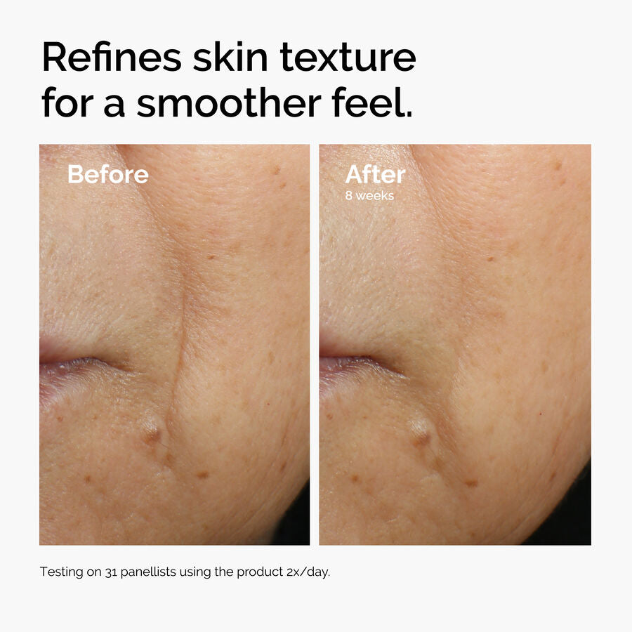 caffeine-3-escin-1-face-serum-v1 ord-caffeine-3pct-escin-1pct-face-serum-before-after-texture.jpg
