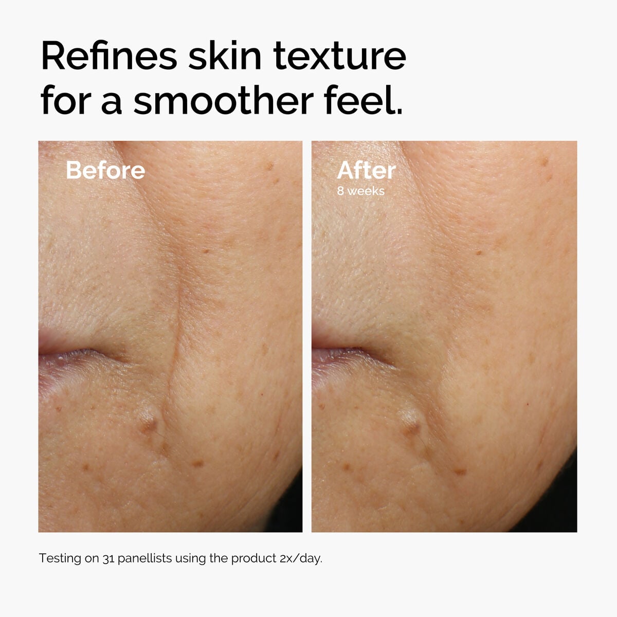 caffeine-3-escin-1-face-serum-v1 ord-caffeine-3pct-escin-1pct-face-serum-before-after-texture.jpg