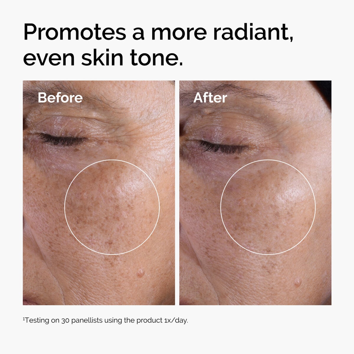 glycolic-acid-7-exfoliating-toner-z4 ord-glycolic-before-after-radiance.jpg