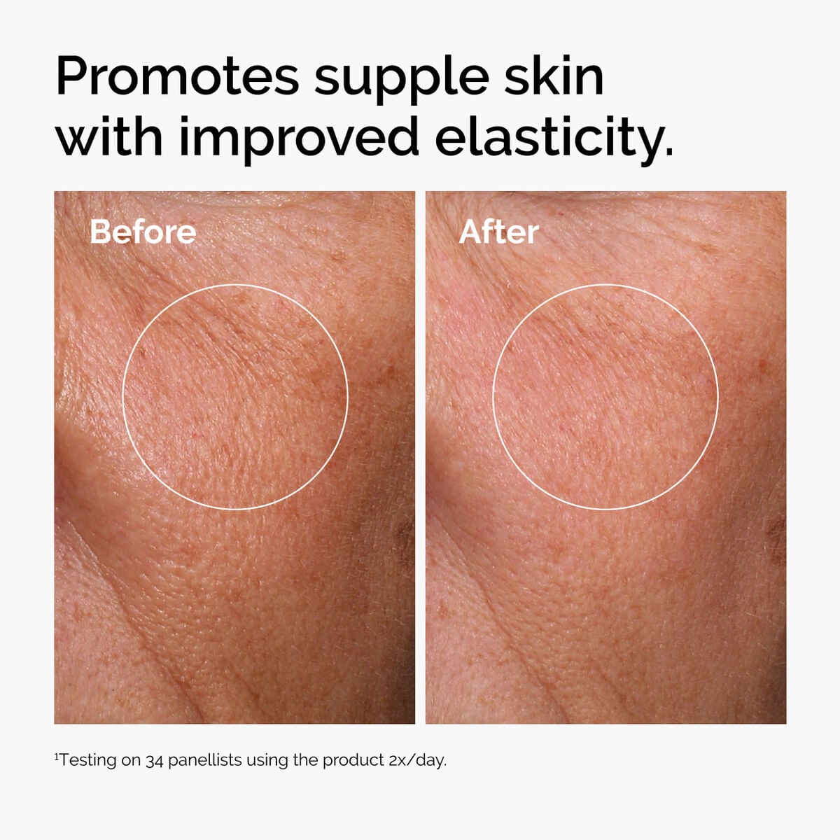 hyaluronic-acid-2-b5-with-ceramides-p8 ord-hyaluronic-acid-2pct-b5-hydrating-serum-before-after-elasticity.jpg