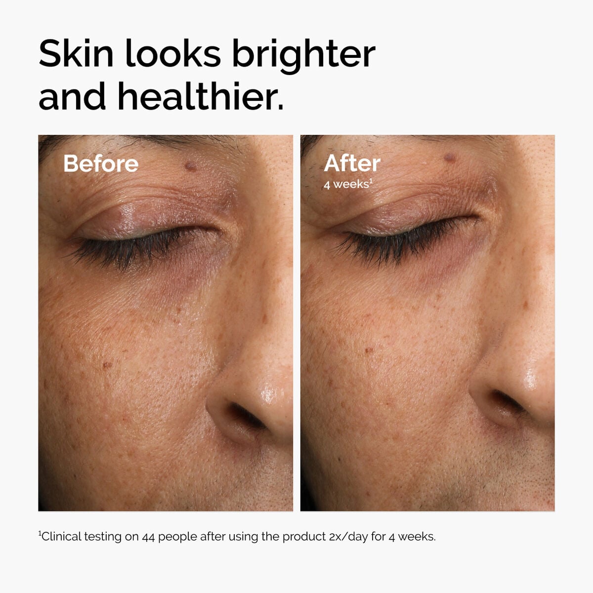 multi-antioxidant-radiance-serum-p6 ord-mars-before-after-healthy.jpg