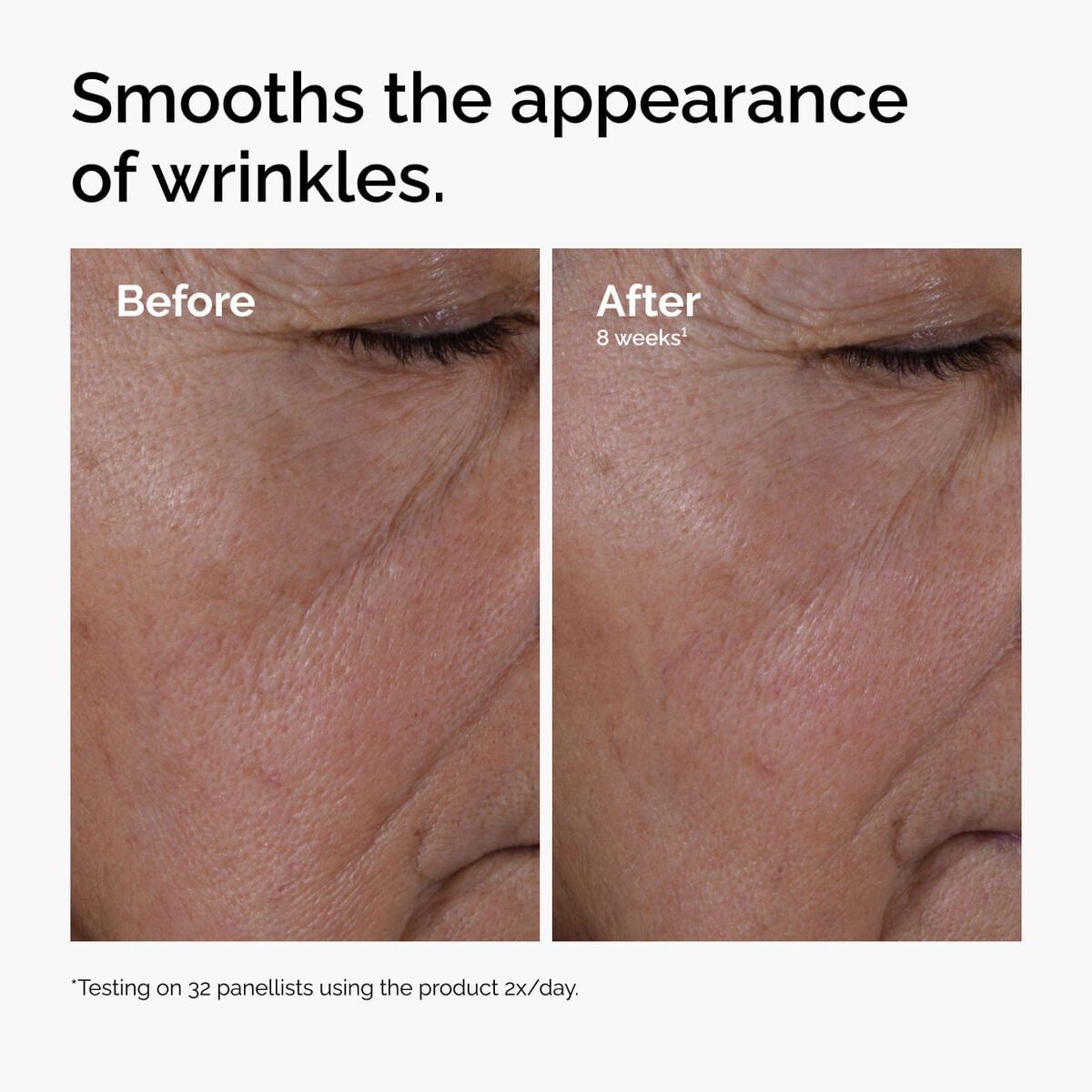 multi-peptide-ha-serum-c1 ord-multi-peptide-ha-serum-wrinkles-before-after.jpg