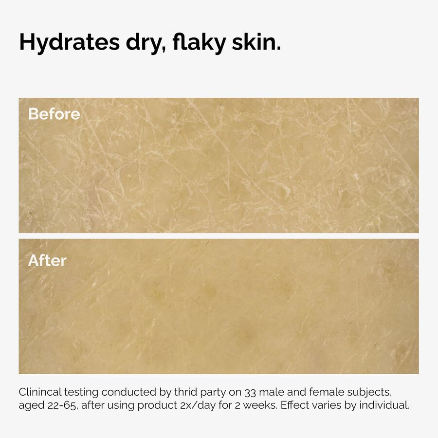 the-body-care-collection-z4 ord-natural-moisturizing-factors-inulin-body-before-after-graphic-02.jpg