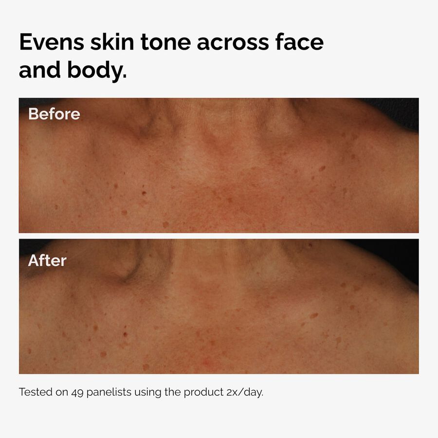 the-body-care-collection-z4 ord-niacinamide-face-body-serum-before-after-even-tone-graphic.jpg
