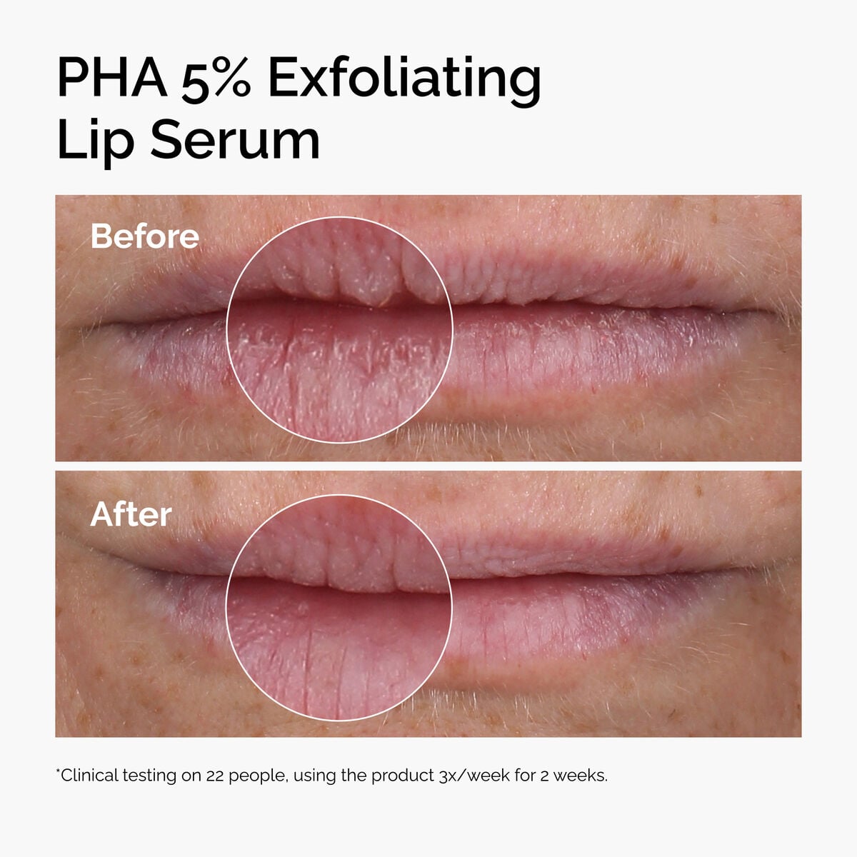 pha-5-exfoliating-lip-serum-p9 ord-pha-5pct-lip-exfoliating-serum-before-after.jpg